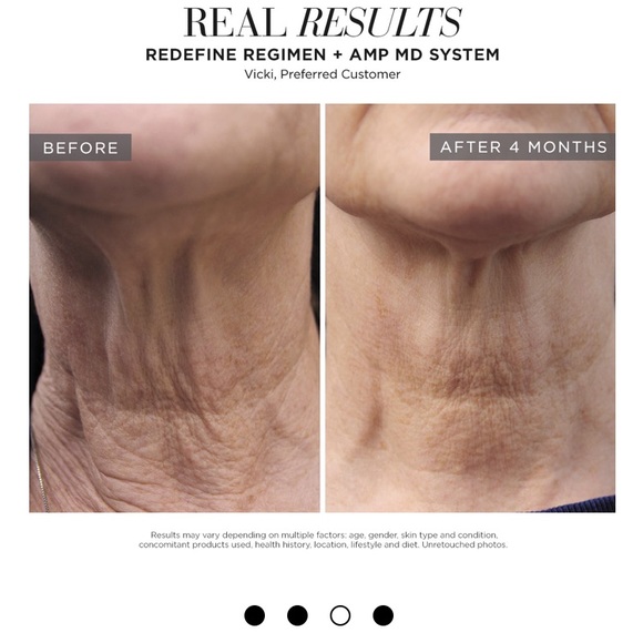 Rodan + Fields AMP MD System - Picture 4 of 4